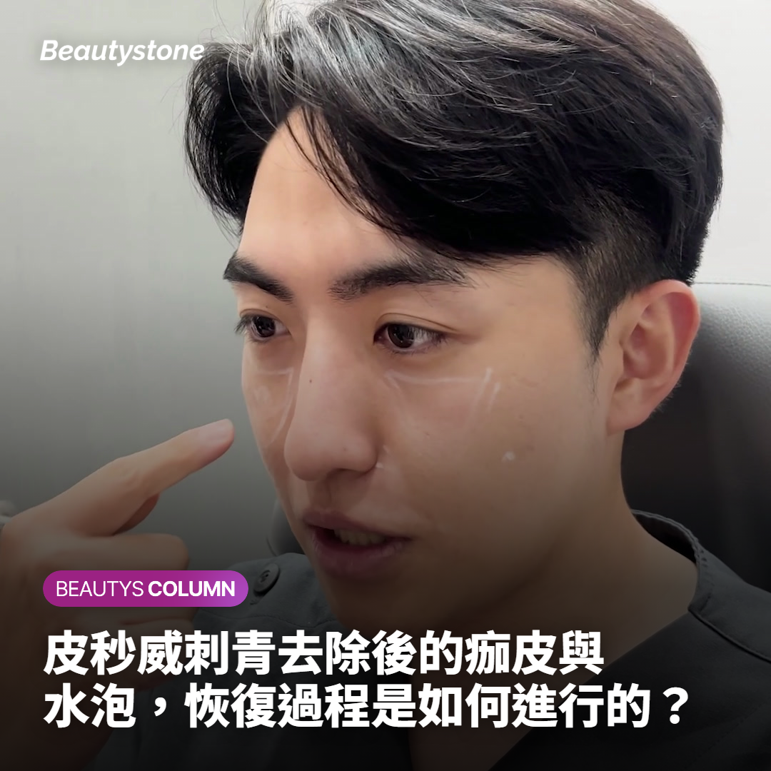 皮秒威刺青去除後的痂皮與水泡，恢復過程是如何進行的？