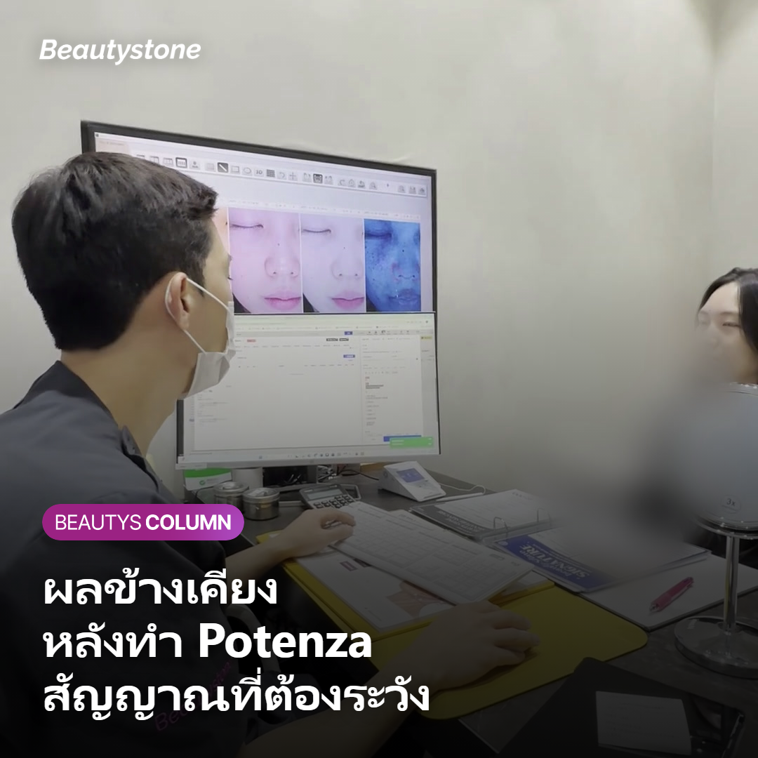 ผลข้างเคียงและสัญญาณที่ต้องระวังหลังทำ Potenza