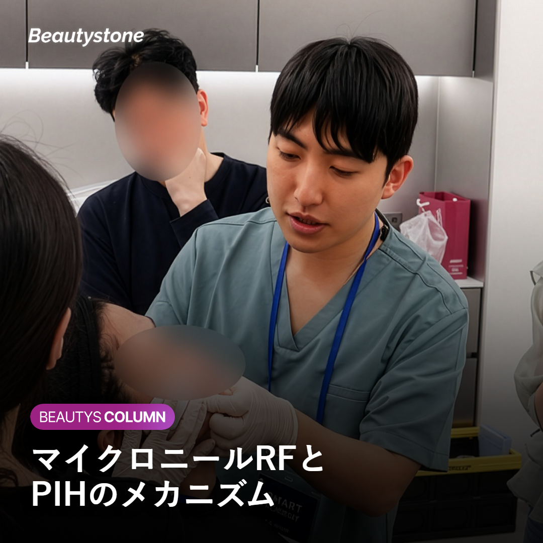 ポテンツァ後の色素沈着はなぜ長引く？やりがちな誤解と正しい対処法