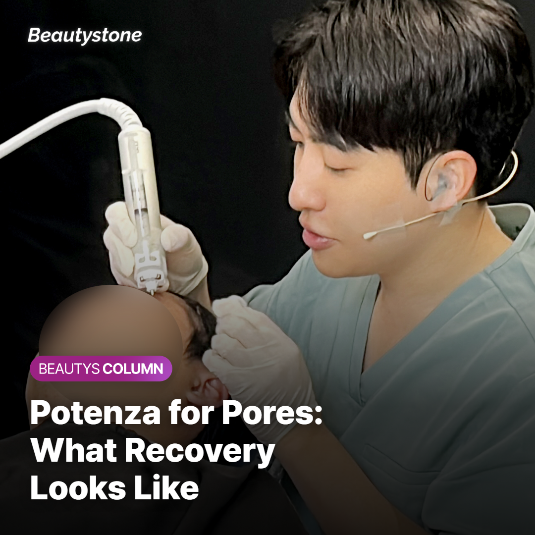Potenza for Pore Tightening — How Many Days Does Recovery Take, and What Reactions Are Common?