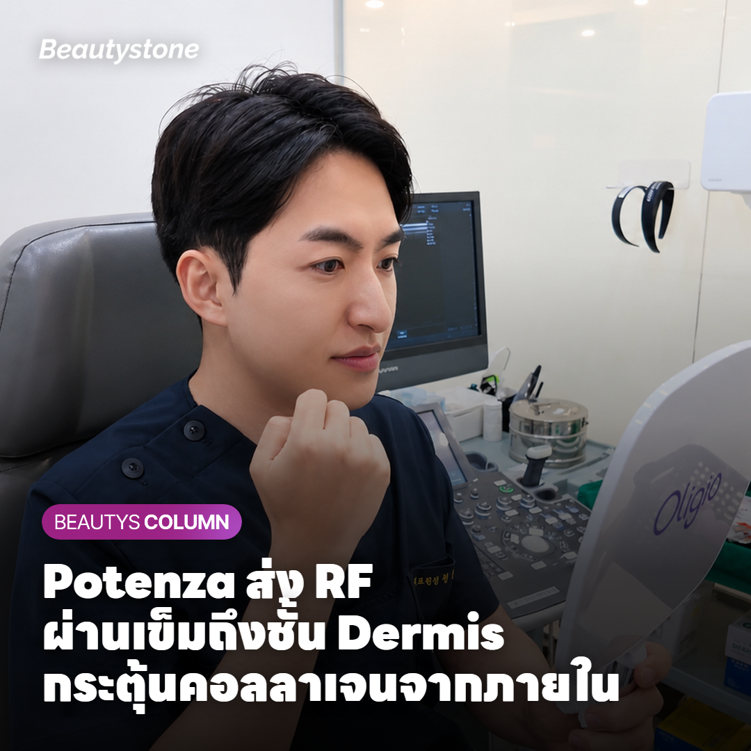 กลไก Potenza RF Microneedling ส่งพลังงานผ่านเข็มถึงชั้น Dermis กระตุ้นการสร้างคอลลาเจน