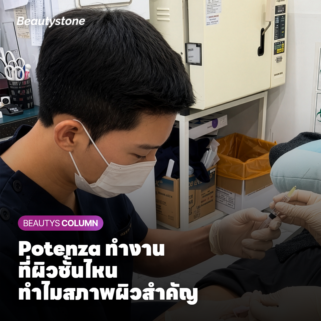Potenza ทำงานที่ผิวชั้นไหน ทำไมสภาพผิวก่อนทำถึงสำคัญ