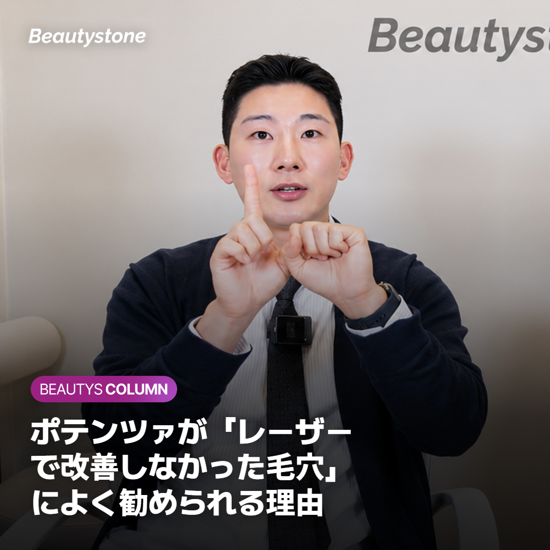 ポテンツァがレーザーで改善しなかった毛穴によく勧められる理由