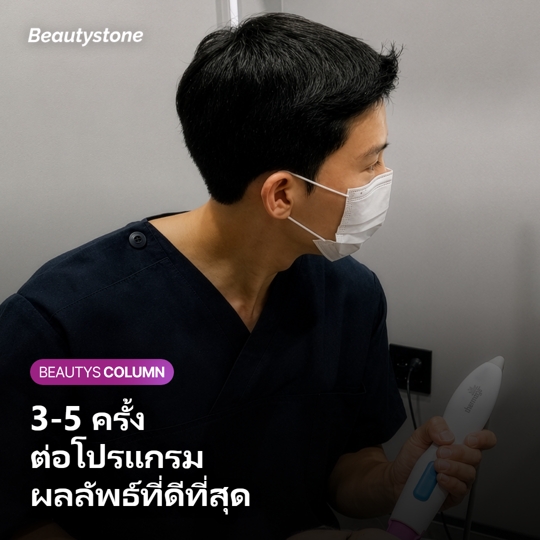 ระยะห่างระหว่างเซสชั่น Potenza 3-4 สัปดาห์