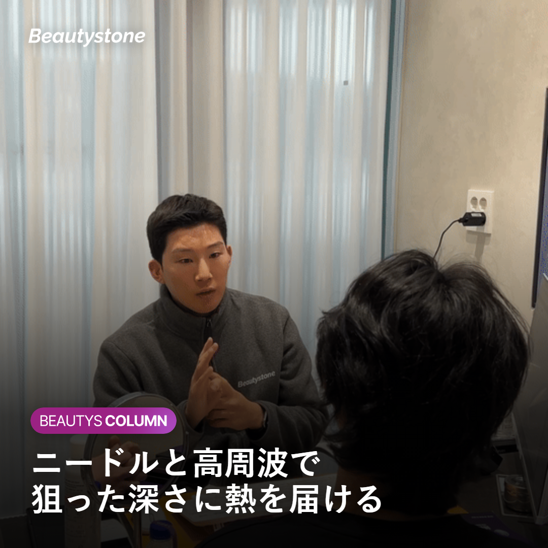 ポテンツァとは？マイクロニードルRFの仕組み