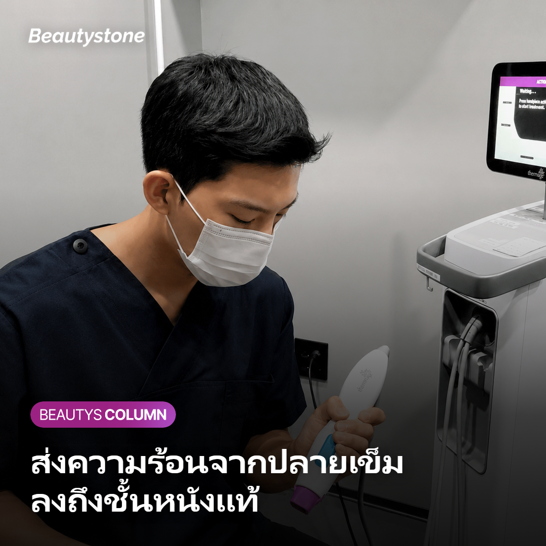 ภาพอธิบายการส่งความร้อนคลื่นวิทยุลงชั้นหนังแท้ด้วยเข็มขนาดเล็ก