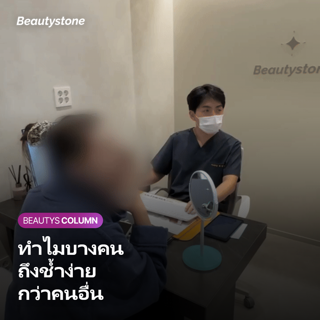 ภาพแสดงสาเหตุที่บางคนช้ำง่ายกว่าคนอื่น