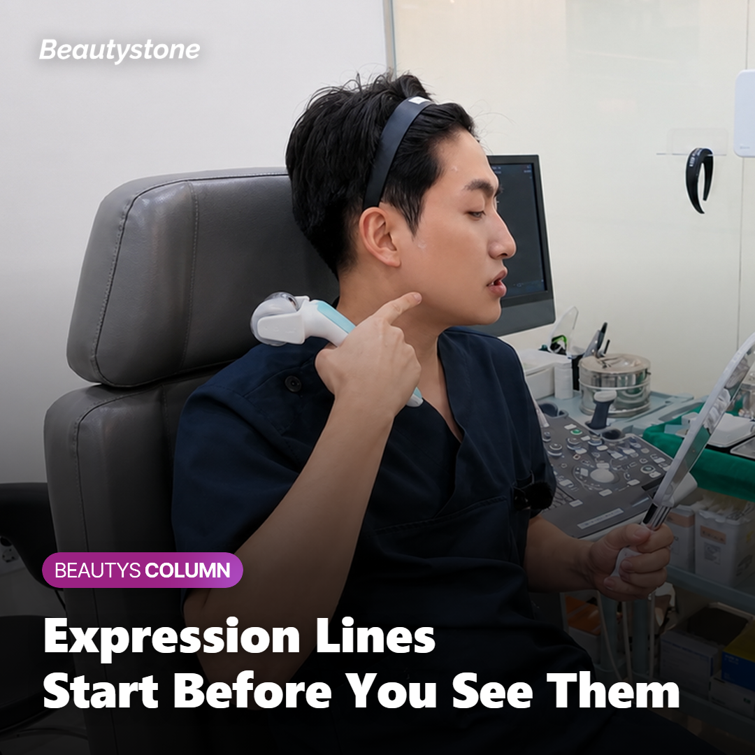 How Do Expression Lines Form in the First Place?