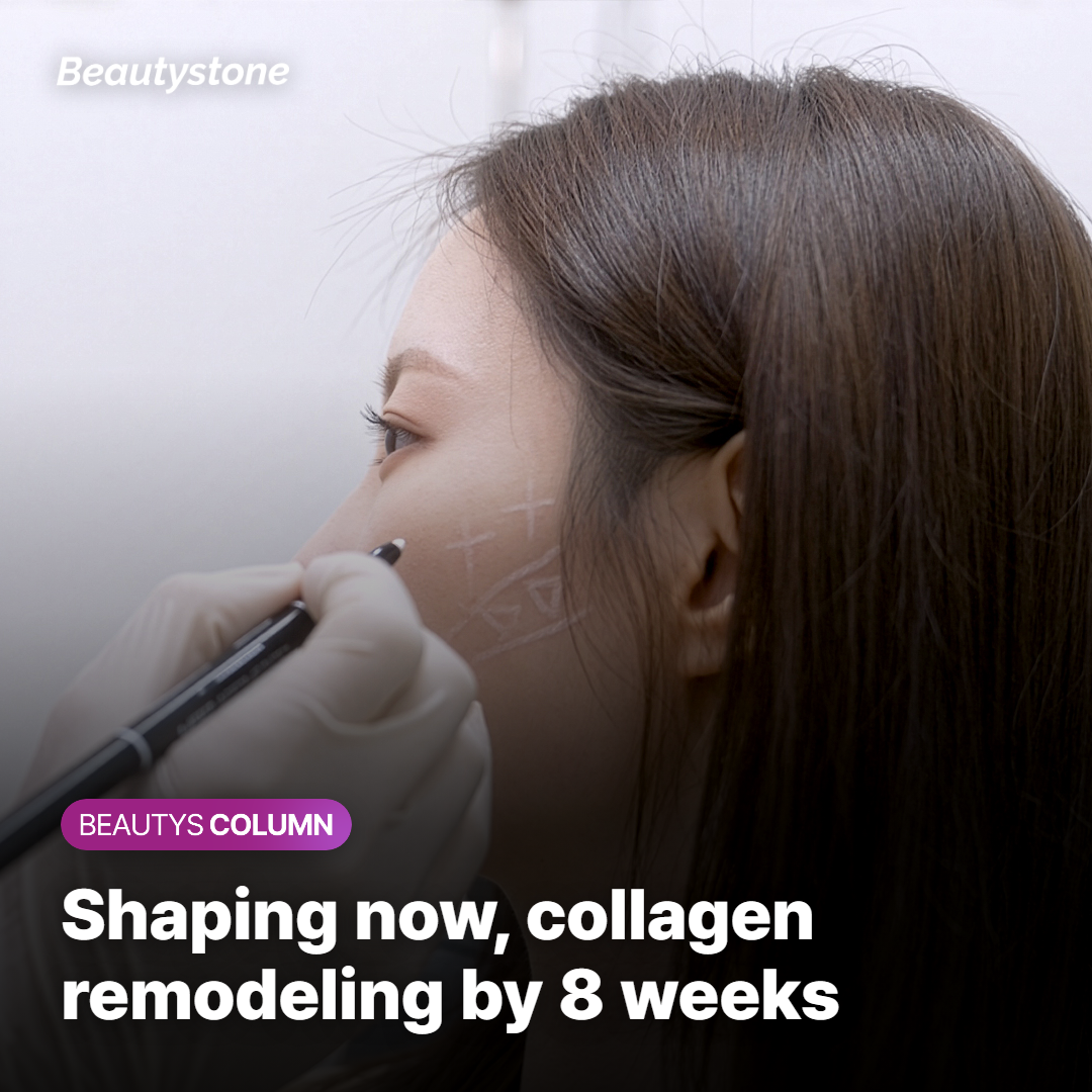 Radiesse mechanism timeline: immediate structural shaping followed by Collagen remodeling at 6–8 weeks