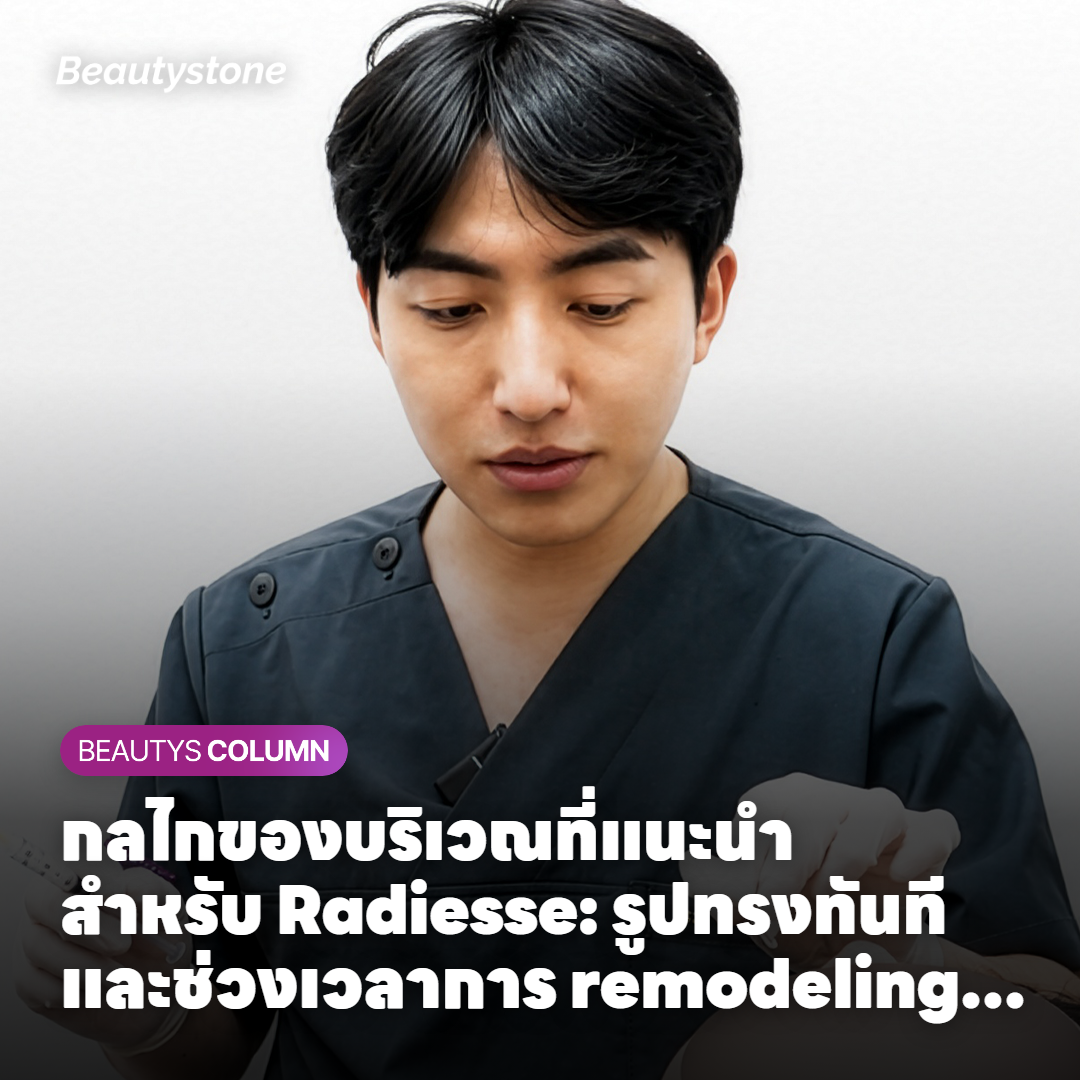 กลไกของบริเวณที่แนะนำสำหรับ Radiesse: รูปทรงทันทีและช่วงเวลาการ remodeling คอลลาเจน 6-8 สัปดาห์