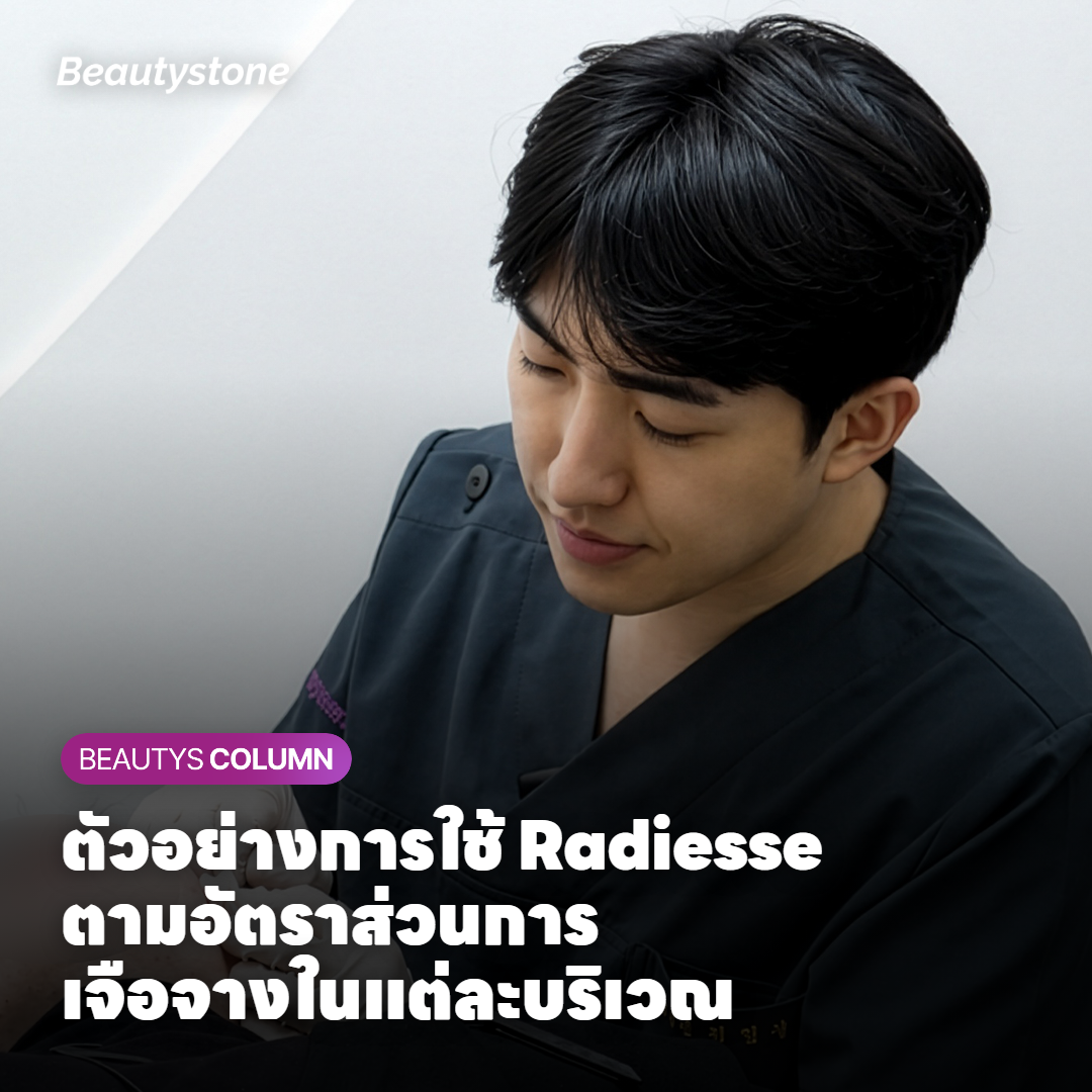 ตัวอย่างการใช้ Radiesse ตามอัตราส่วนการเจือจางในแต่ละบริเวณ