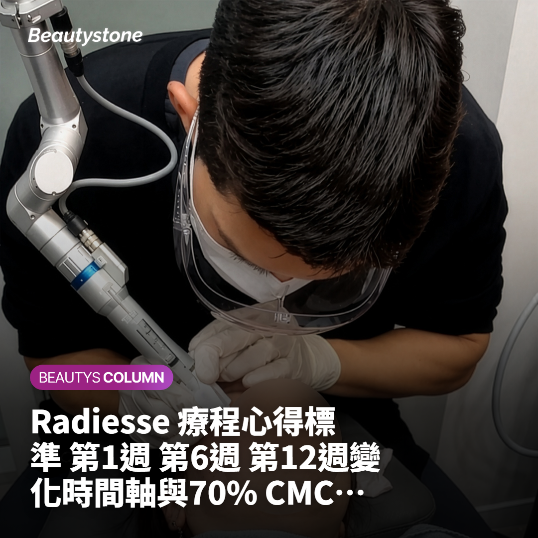 Radiesse 療程心得標準 第1週 第6週 第12週變化時間軸與70% CMC 凝膠區間標示