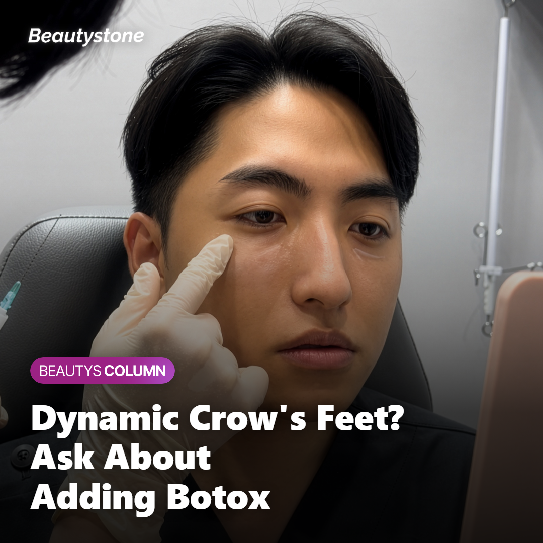 Consultation scene for combining Rejuran HB and Botox for crow's feet treatment