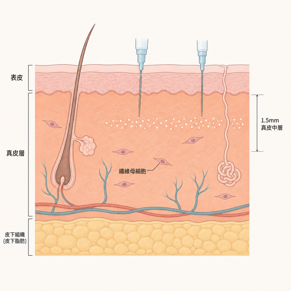 真皮層中的纖維母細胞與新生膠原蛋白
