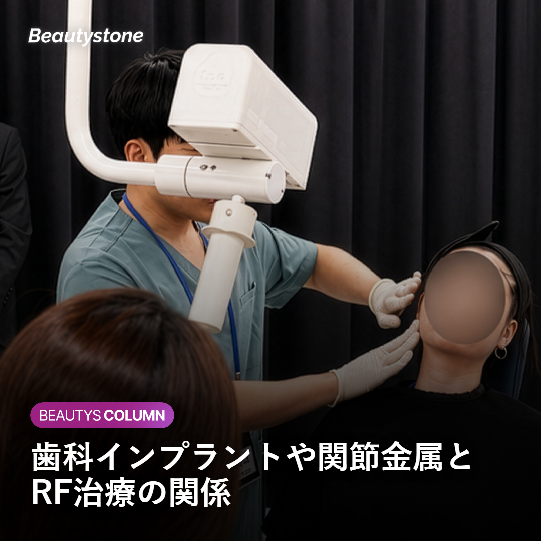 歯科インプラント・関節金属・その他金属がある場合
