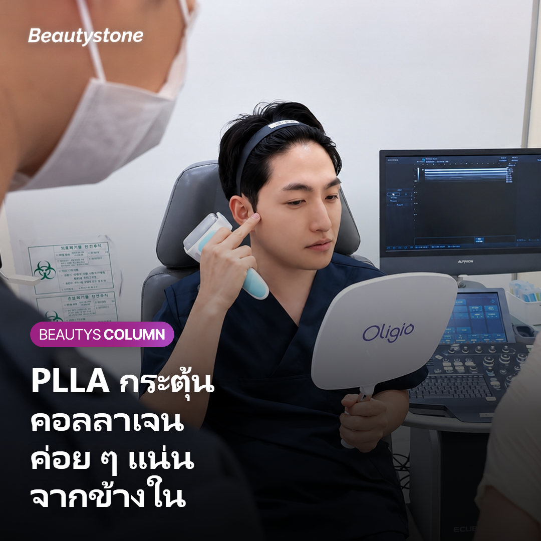 Sculptra คืออะไร และทำงานอย่างไรกับผิวคอ