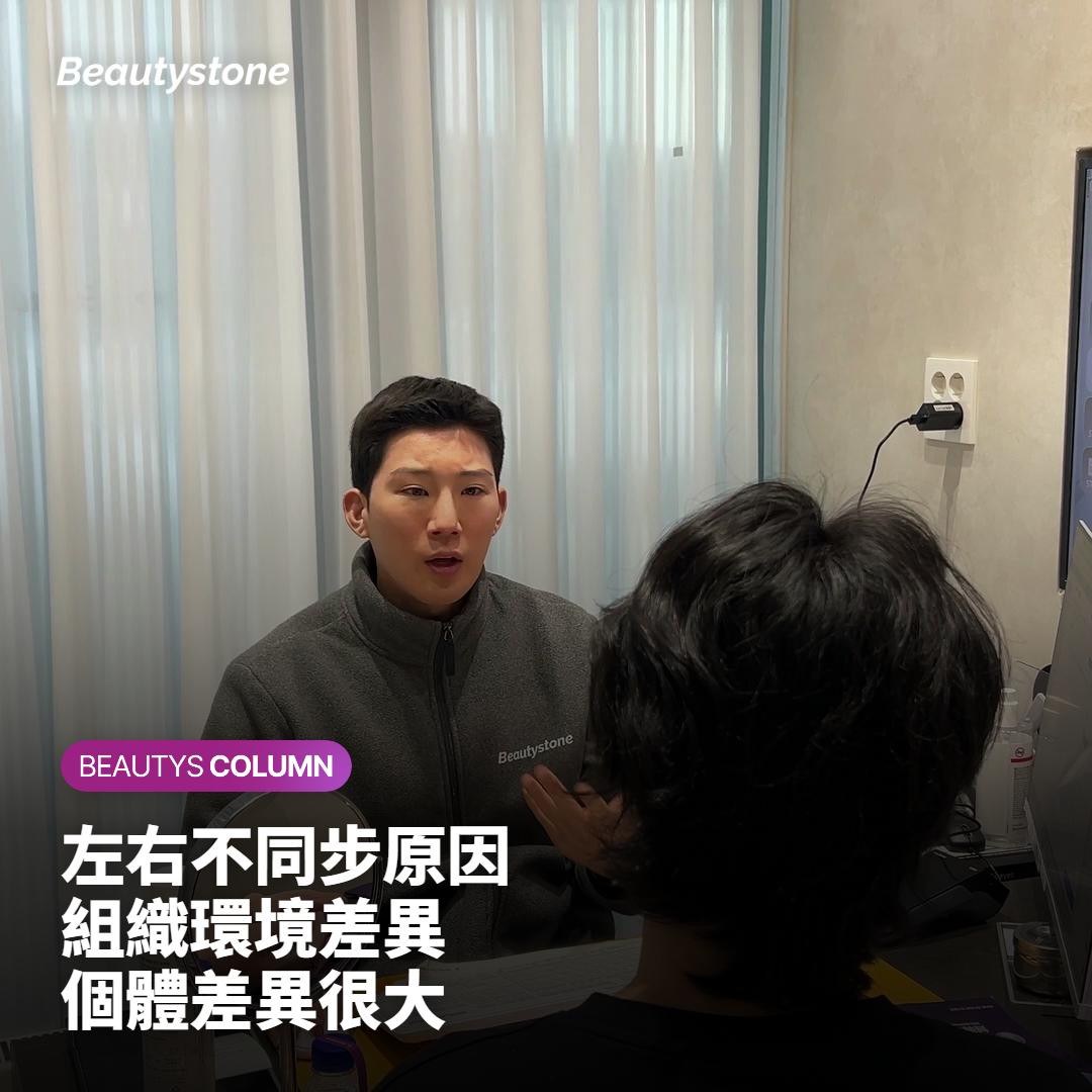 哪些差異屬於正常的過渡期範圍？