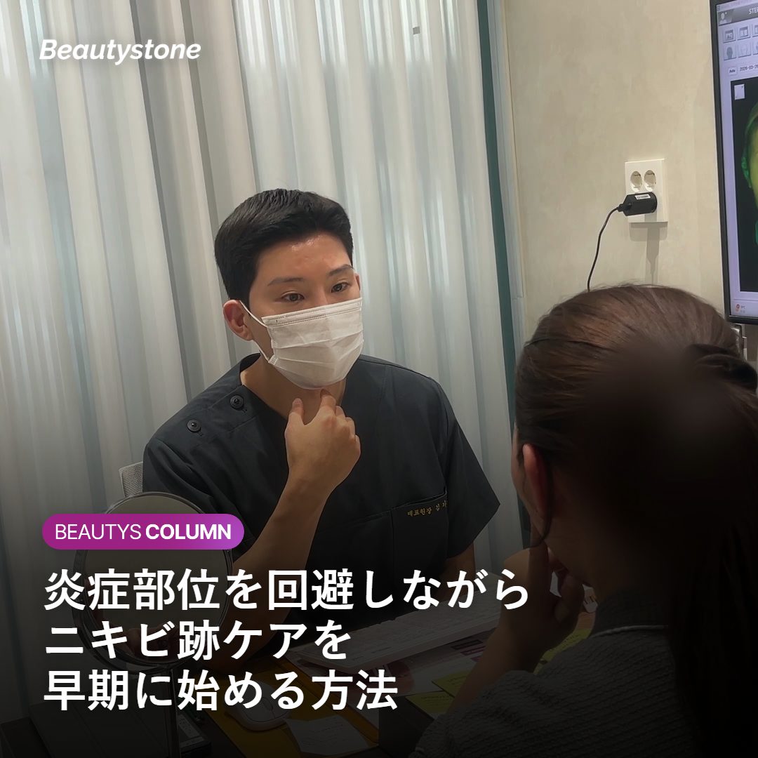 炎症部位を回避しながらニキビ跡に施術を行う病変マッピングのイメージ