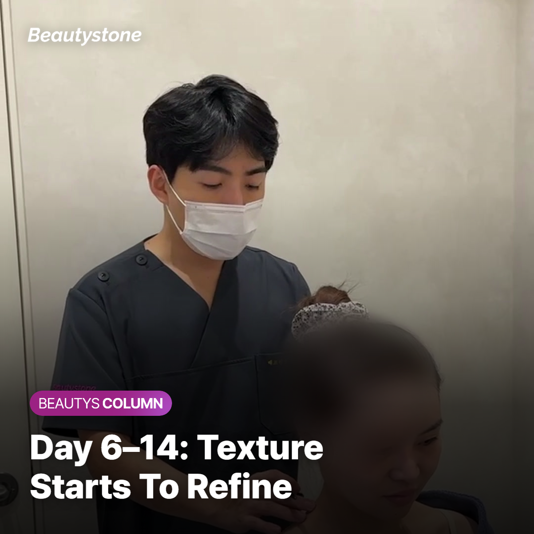 Day 6–Day 14 — Skin Smooths Out and Texture Refines