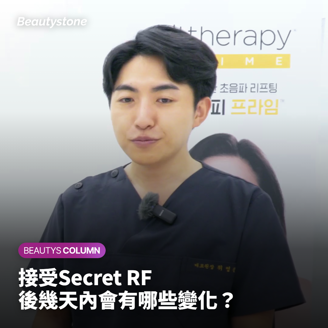 接受Secret RF後幾天內會有哪些變化？