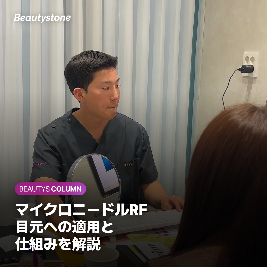 シークレットRFの仕組みと目元への適用範囲