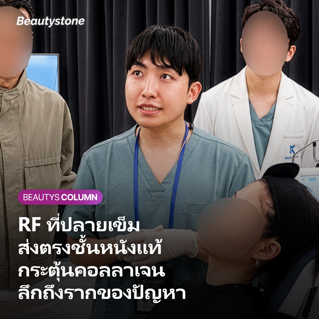 กลไก Secret RF ปล่อยพลังงาน RF ในชั้นหนังแท้เพื่อกระตุ้นคอลลาเจน
