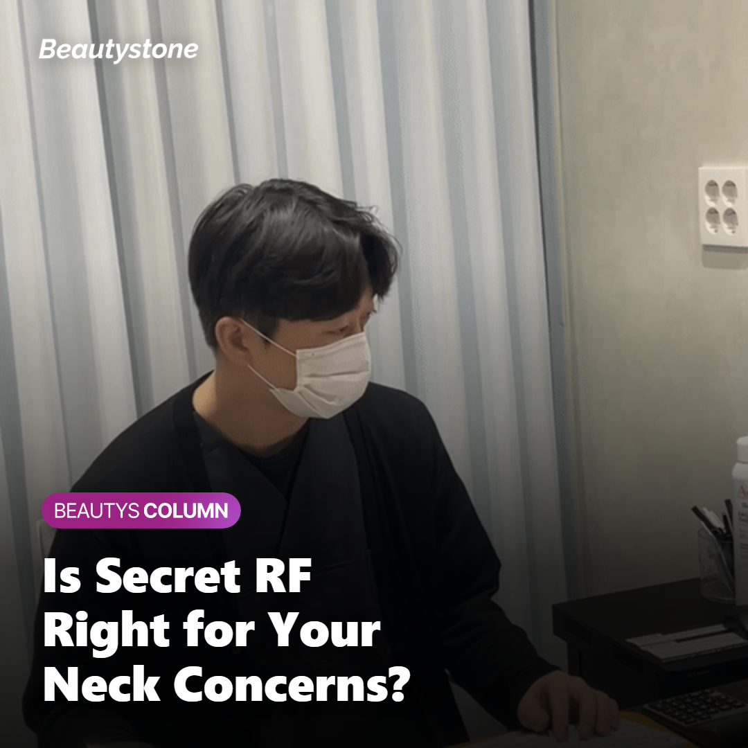 How Much Does Secret RF Cost, and Is It Worth It?