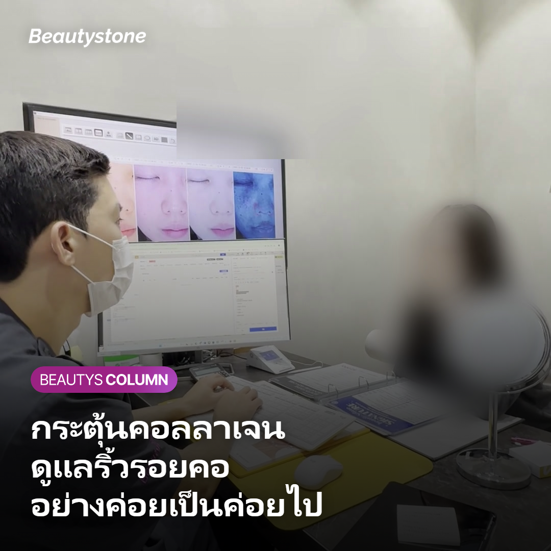 Secret RF ดูแลริ้วรอยคอและความกระชับได้แค่ไหน?