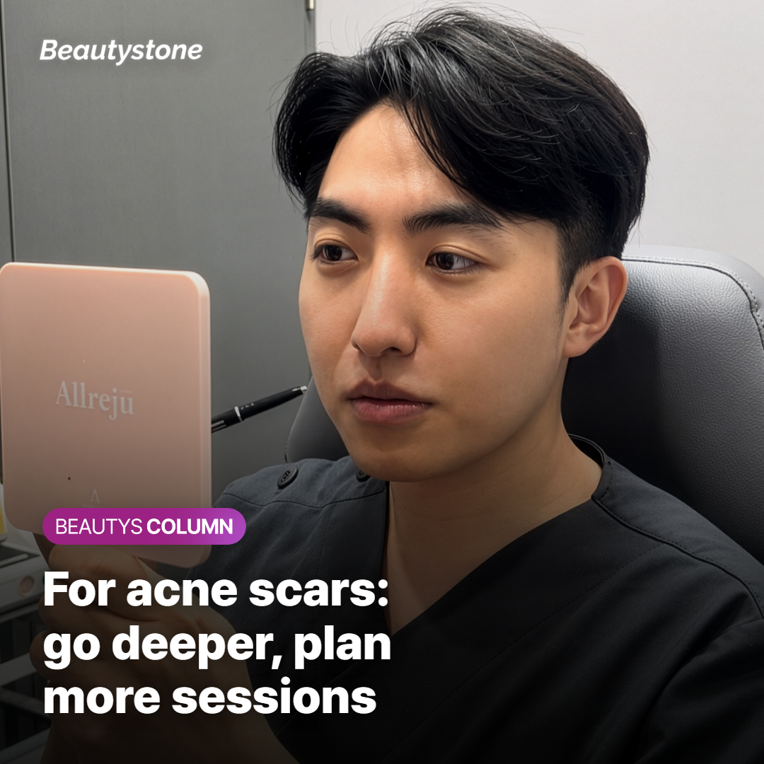 If Acne Scars Are Your Primary Concern — Deeper Depth and More Sessions Are Necessary