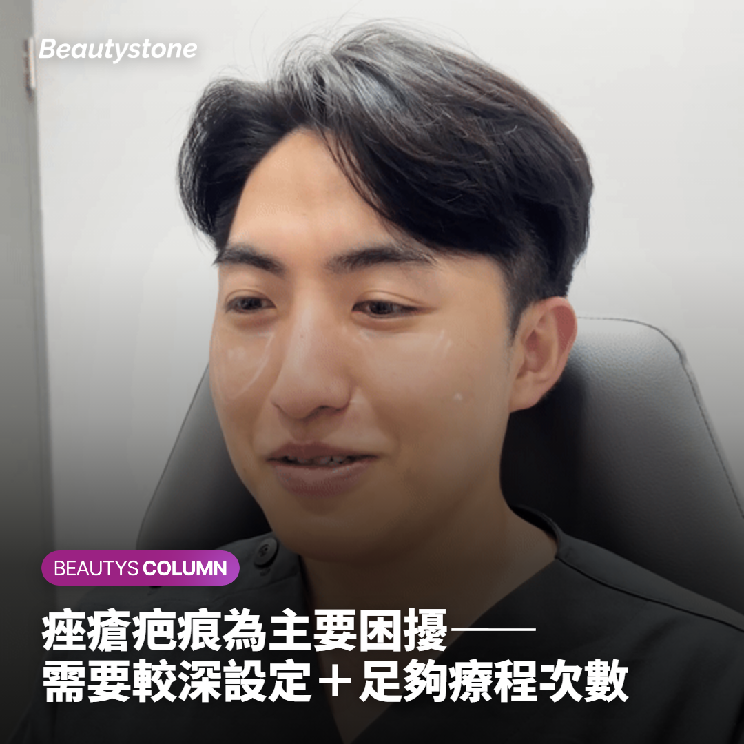 痤瘡疤痕為主要困擾——需要較深設定＋足夠療程次數