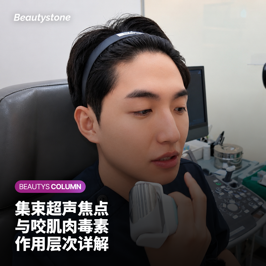 面部下颌区皮肤层次示意，显示HIFU焦点深度与咬肌肉毒素注射位置