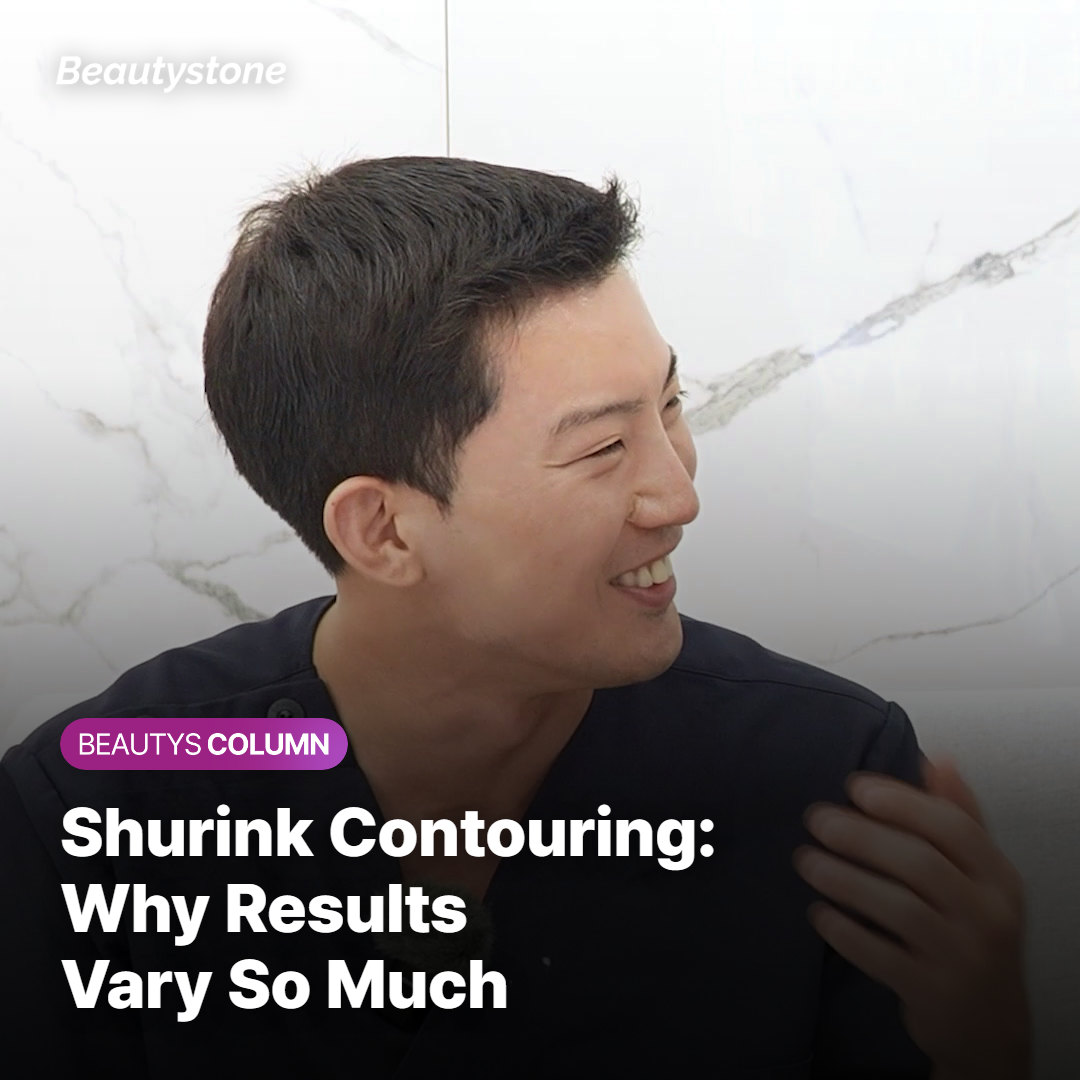Shrink contour review 4.5 3.0 tip combination V-line effect