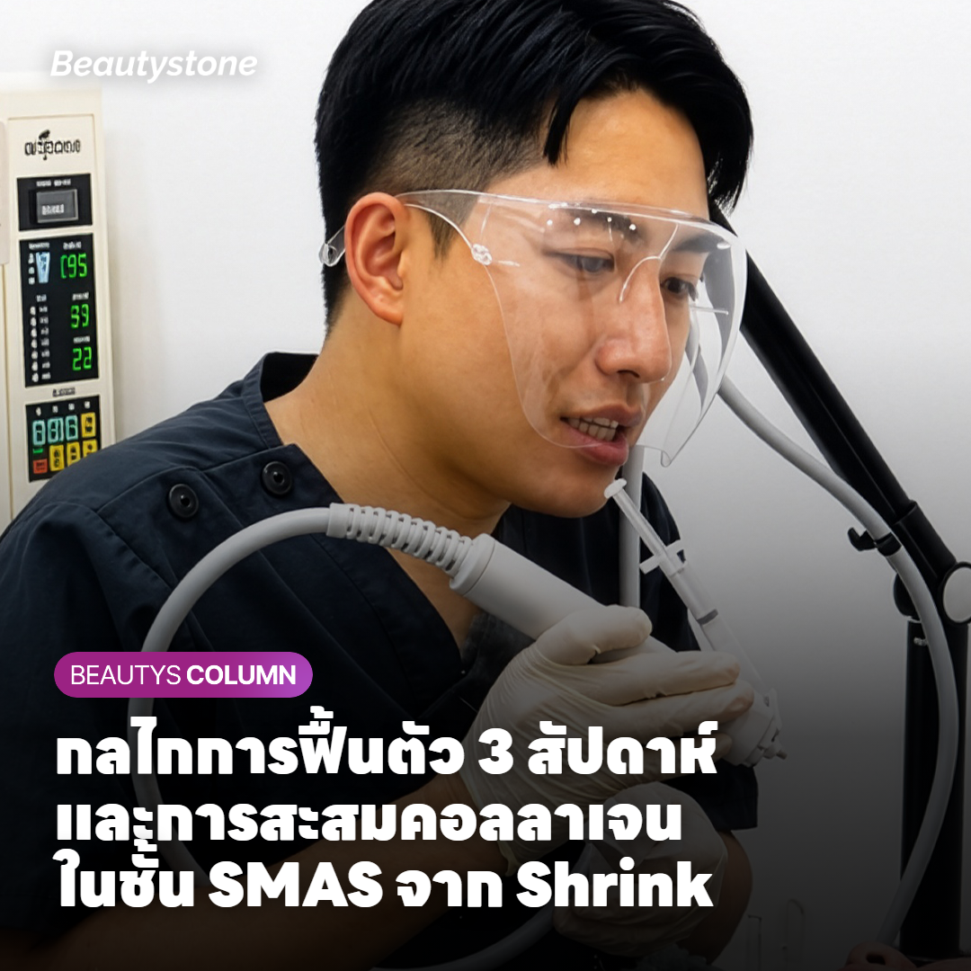 กลไกการฟื้นตัว 3 สัปดาห์และการสะสมคอลลาเจนในชั้น SMAS จาก Shrink