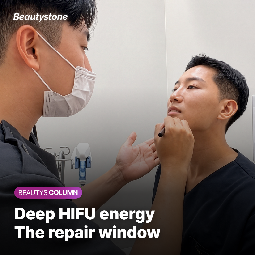 Diagram showing focused HIFU ultrasound energy targeting the SMAS layer beneath intact skin during Shurink Universe treatment