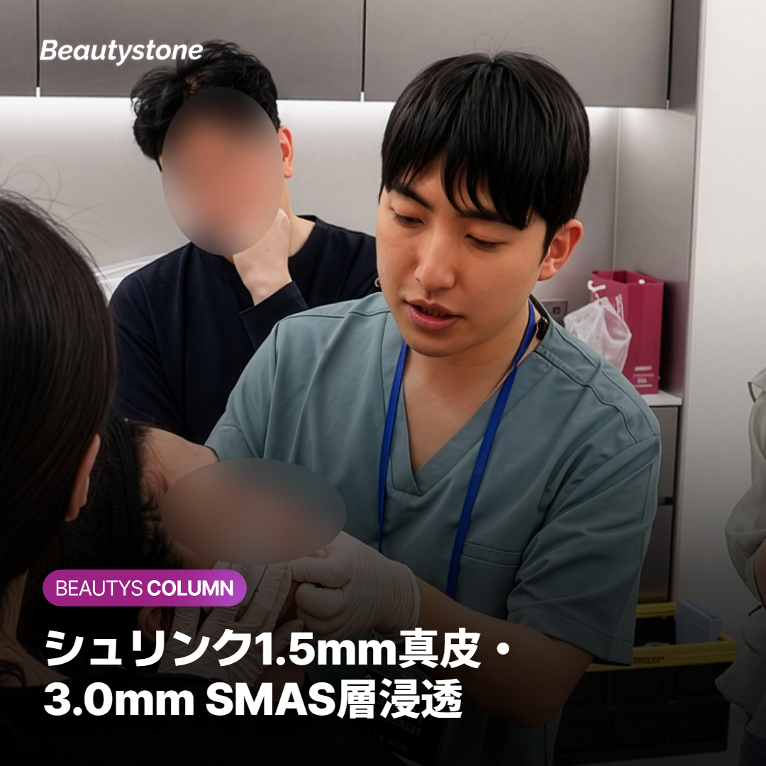 シュリンク1.5mm真皮・3.0mm SMAS層浸透
