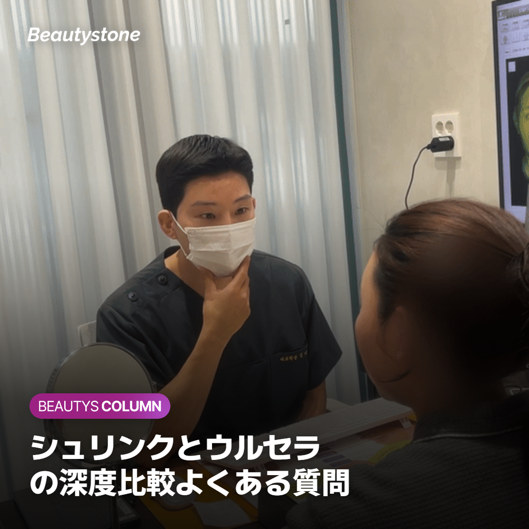 シュリンクとウルセラの深度比較よくある質問
