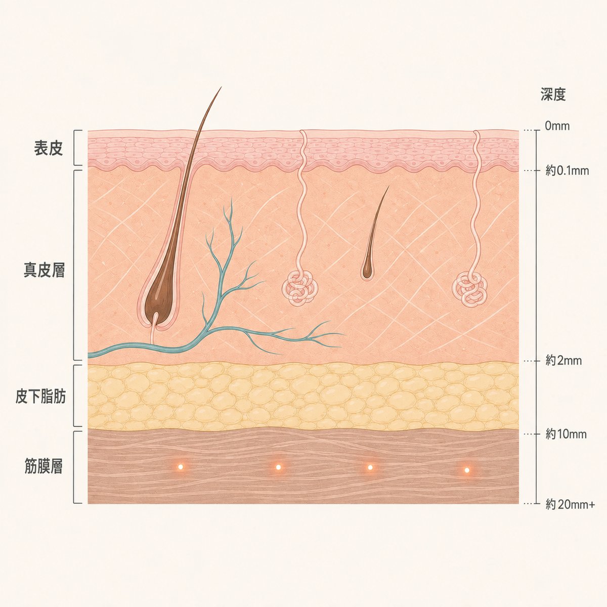 超聲波能量集中於深層筋膜的示意圖