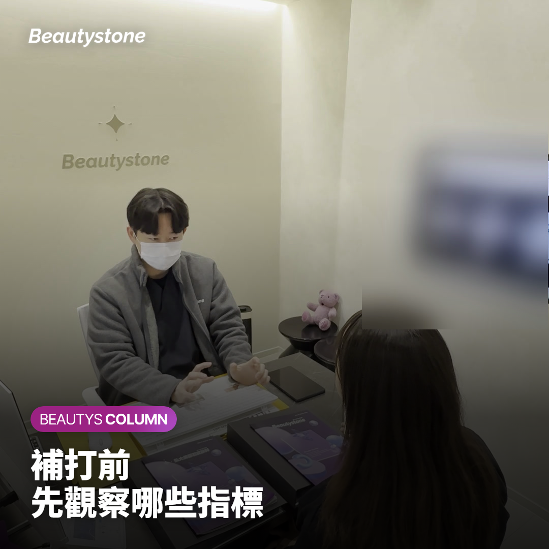 補打前可以自己先觀察哪些指標
