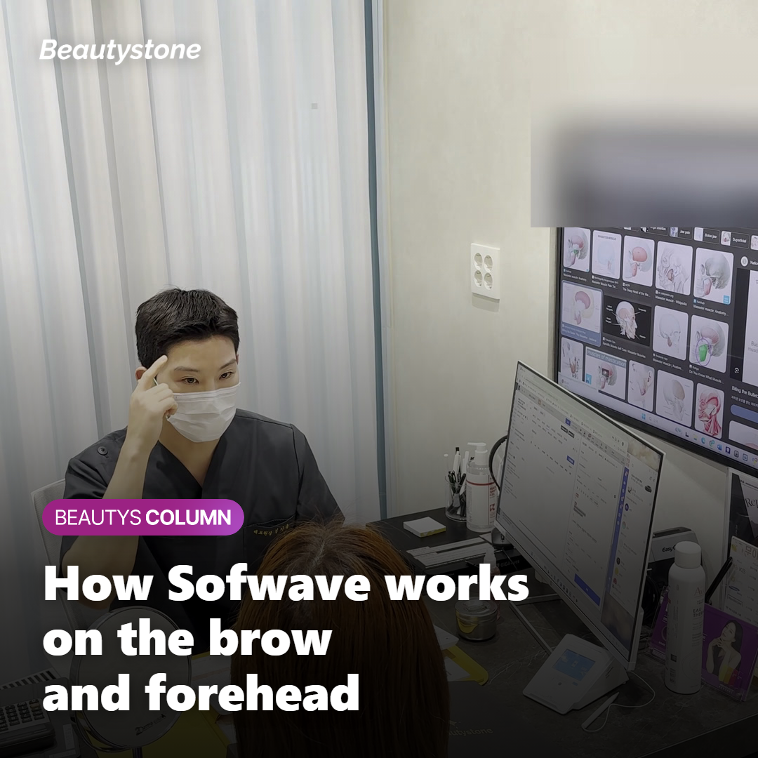 Illustration of how Sofwave works on the brow and forehead