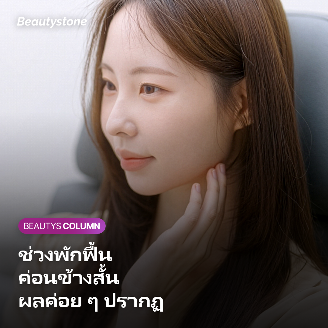 ภาพแสดงไทม์ไลน์การฟื้นตัวหลังทำ Sofwave