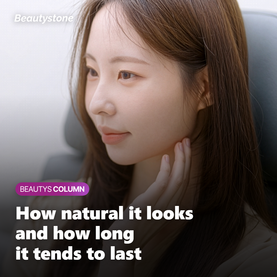 Diagram showing how natural and how long-lasting Sofwave's results tend to be