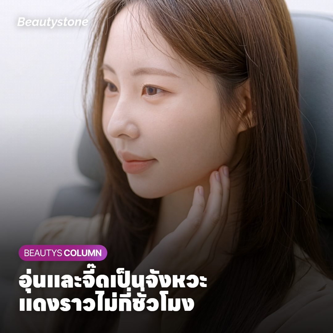 การ์ดสรุปความรู้สึกระหว่างทำและระยะพักฟื้นของ Sofwave