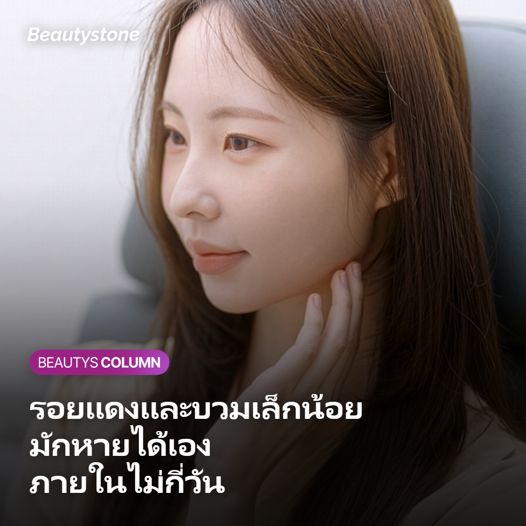 การดูแลผิวหลังทำในช่วงที่ยังมีรอยแดงและบวมเล็กน้อย