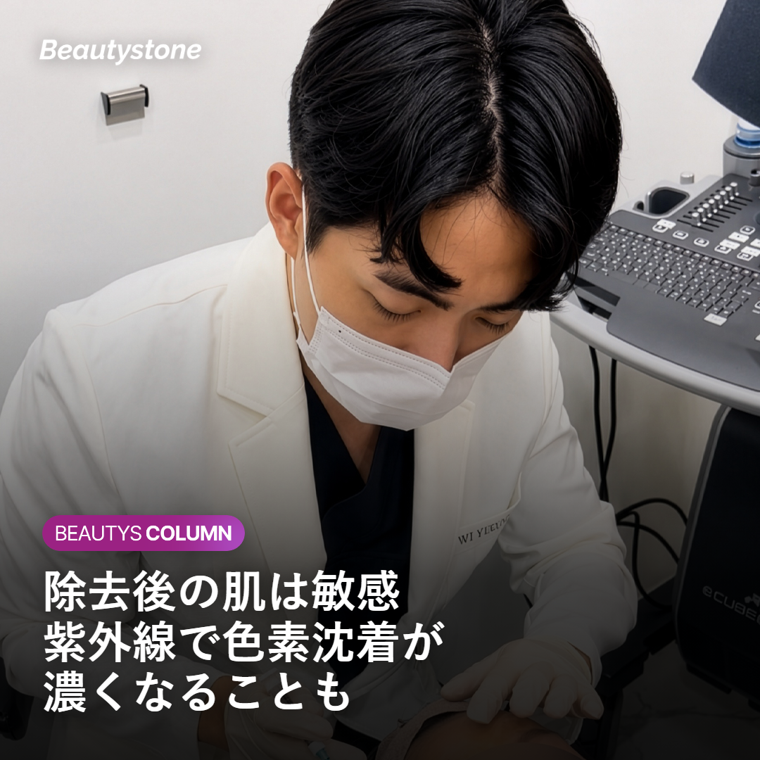 除去後の敏感な肌に紫外線が色素沈着を引き起こす仕組みのイメージ