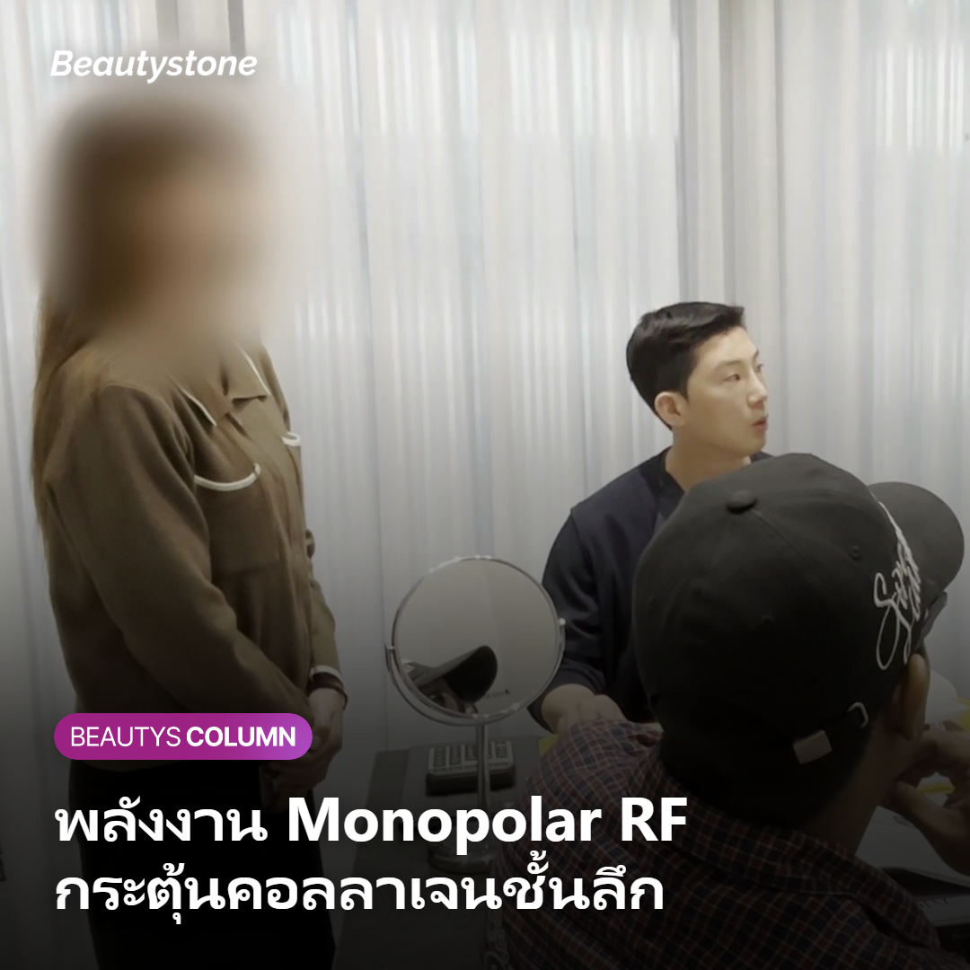 หลักการพลังงาน Monopolar RF ของ Thermage FLX กระตุ้นคอลลาเจนชั้นลึก