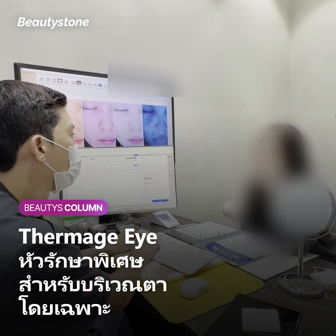 ภาพแสดงกลไก Thermage FLX กับหัวรักษาพิเศษสำหรับบริเวณตา