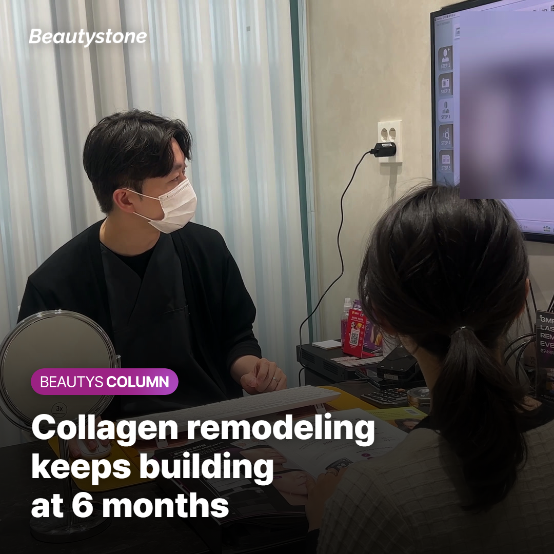 Thermage Collagen remodeling at 6 months