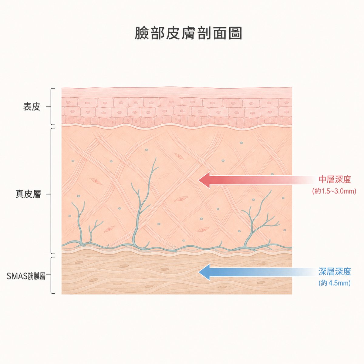 熱瑪吉FLX作用的真皮層與超聲刀作用的更深層次