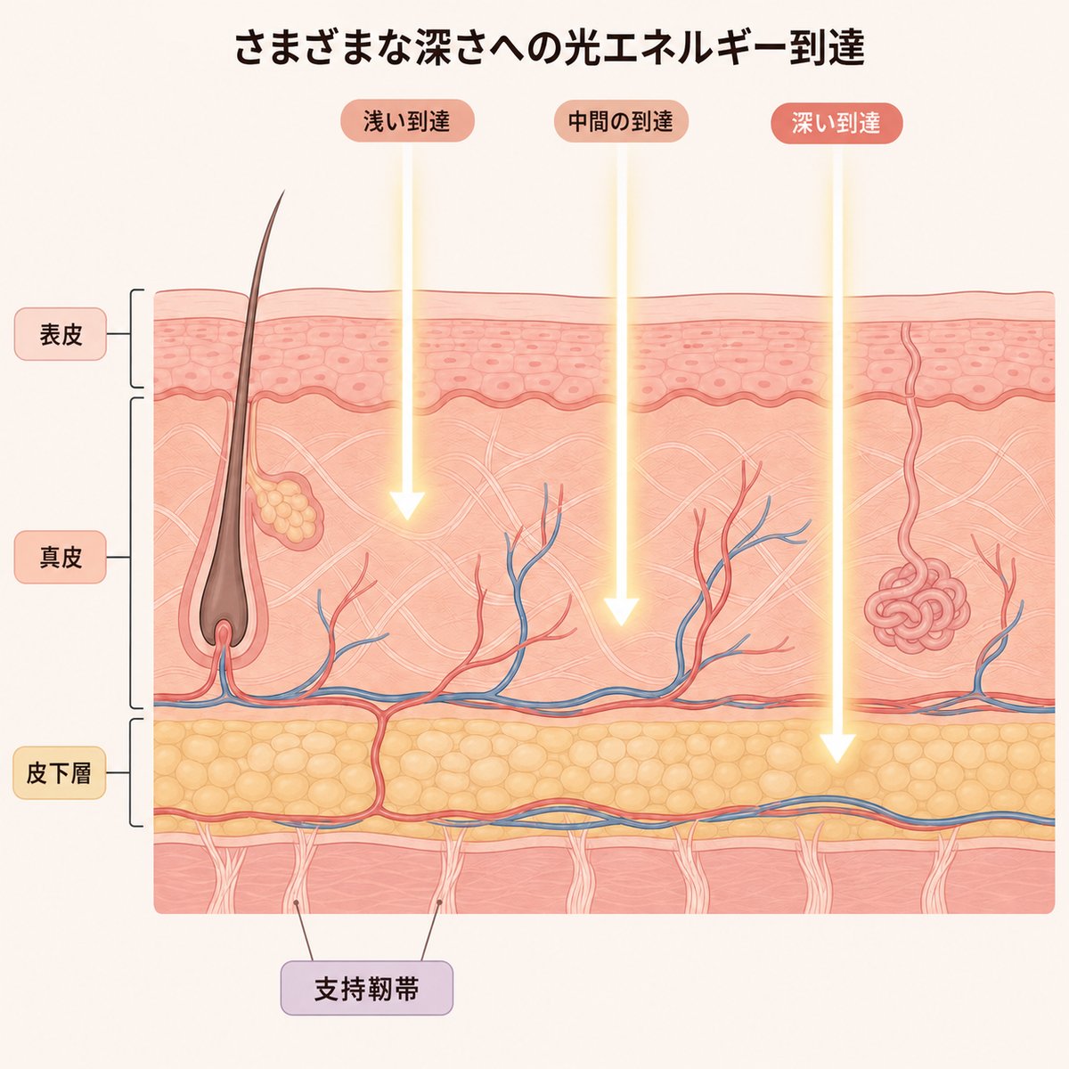3つの波長が真皮と支持靭帯まで熱を伝える位置