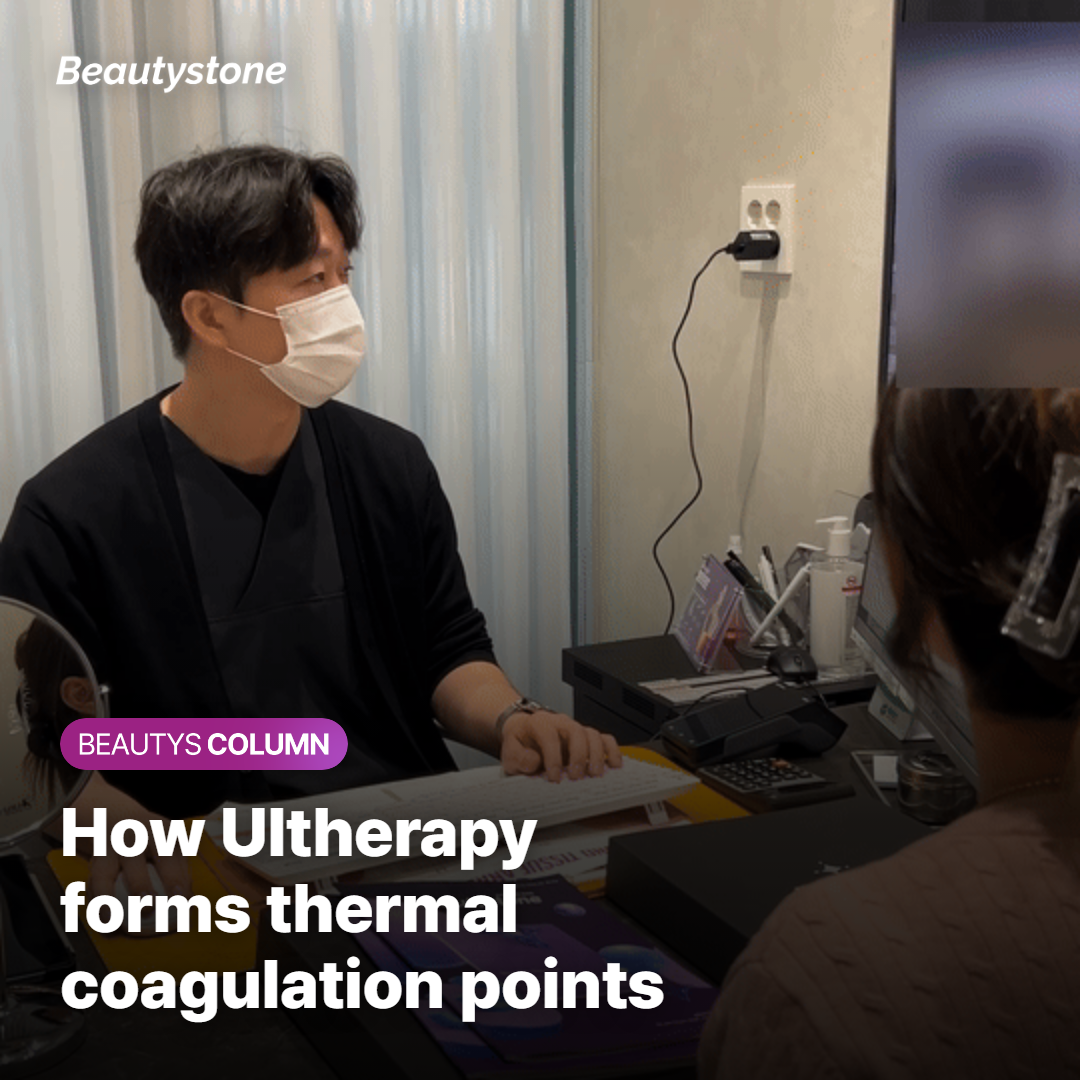 Ultherapy SMAS Layer Thermal Coagulation Point formation
